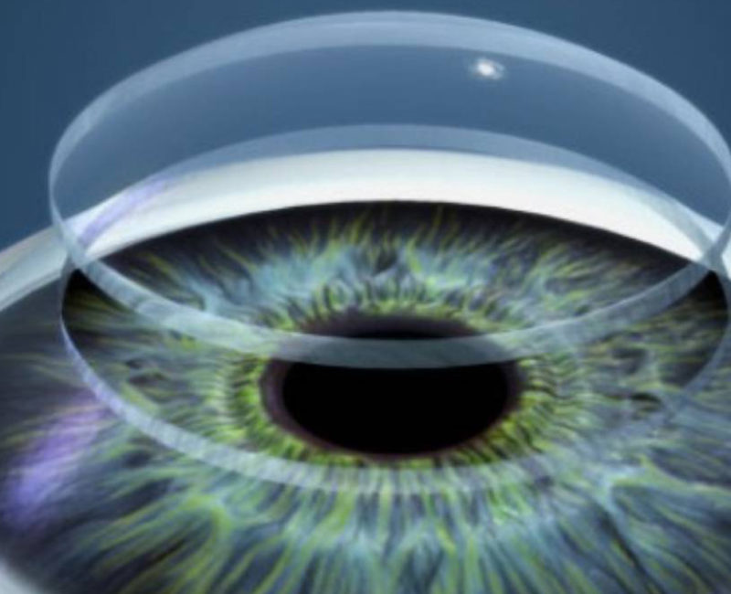 Transplante de Cornea